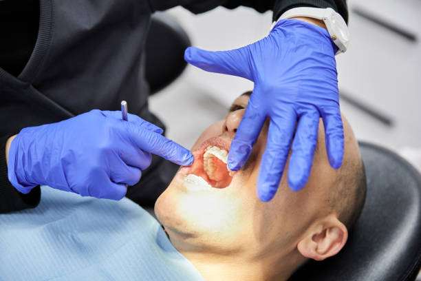 Best Emergency Wisdom Teeth Removal in Holladay, UT